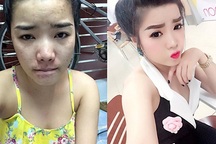 Xôn xao chuyện cô gái đăng ảnh mặt mộc "kém sắc" để từ bỏ "sống ảo"
