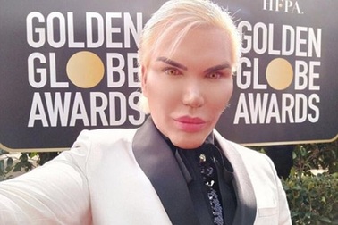 "Búp bê Ken" Rodrigo Alves buồn bực khi quên mặc đồ đen dự lễ trao giải Quả Cầu Vàng