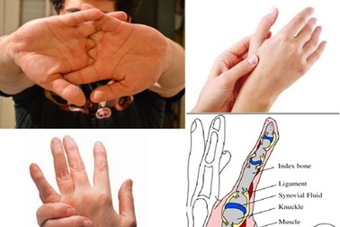 Hệ lụy từ thói quen bẻ khớp ngón tay