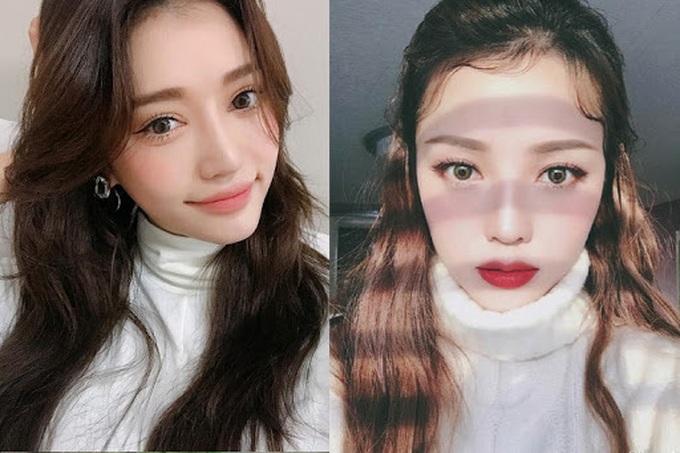 4 điều ai cũng cần "khắc cốt ghi tâm" trước khi thực hiện phẫu thuật thẩm mỹ: Chuyên gia khuyên chị em phải nắm rõ! - Ảnh 3. 4 điều ai cũng cần "khắc cốt ghi tâm" trước khi thực hiện phẫu thuật thẩm mỹ: Chuyên gia khuyên chị em phải nắm rõ! - Ảnh 3.