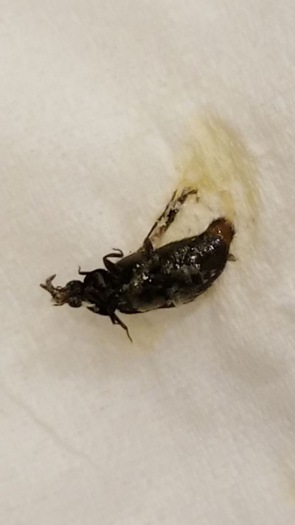 Bọ lớn chui vào tuyến lệ của bé gái 6 tuổi - 3 Bọ lớn chui vào tuyến lệ của bé gái 6 tuổi - 3