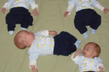 Một ca sinh 4 hiếm gặp ở Mỹ