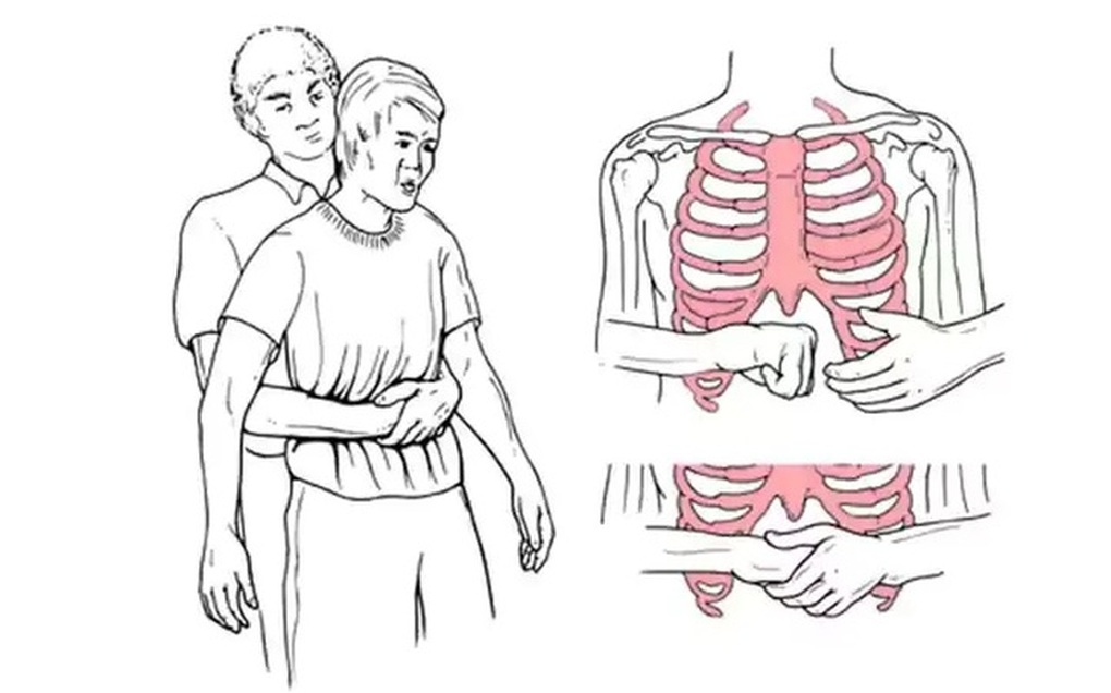Cậu bé 11 tuổi cứu sống em trai bằng động tác Heimlich gây sốt mạng xã hội - 1 Cậu bé 11 tuổi cứu sống em trai bằng động tác Heimlich gây sốt mạng xã hội - 1