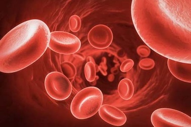 Thiếu máu có liên quan với tăng nguy cơ sa sút trí tuệ