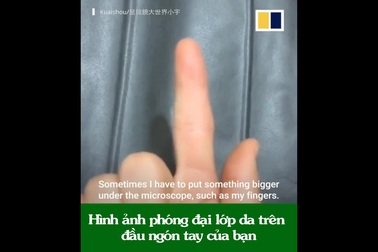 Cảnh quay ở cấp độ hiển vi sẽ khiến bạn nghĩ lại về thói quen ăn đồ sống, lười rửa tay