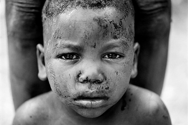 Hủ tục "rạch mặt" trẻ em để đánh dấu tuổi trưởng thành