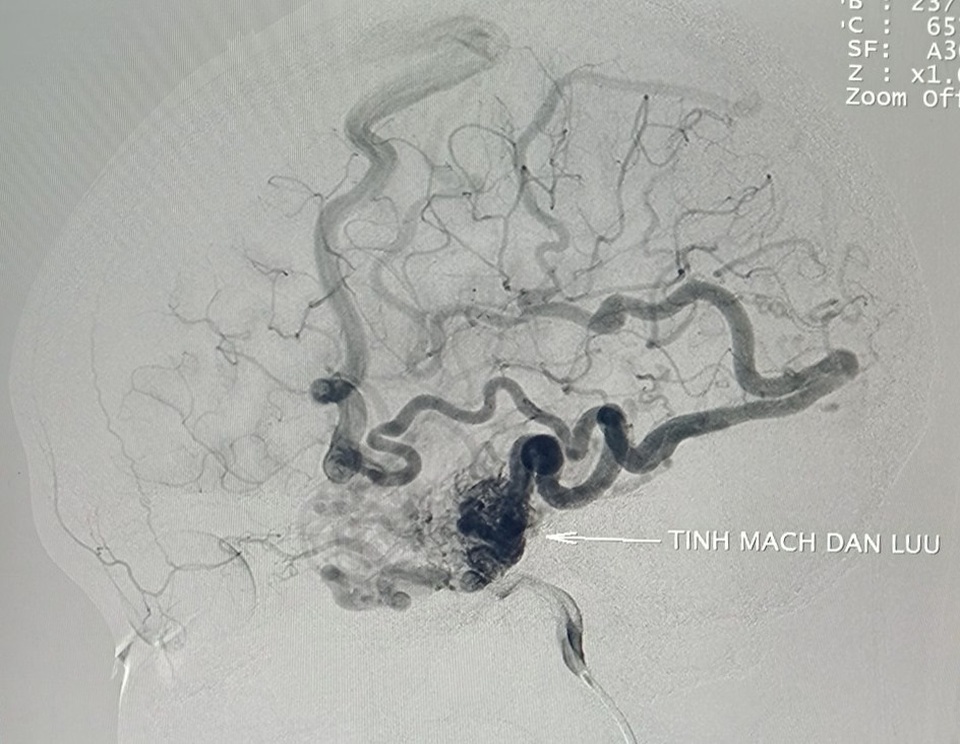 Cô gái trẻ thường xuyên động kinh vì bệnh lý nguy hiểm - 1