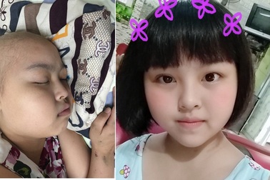 Tình cảnh đáng thương của cô bé dân tộc Sán Dìu bị ung thư máu