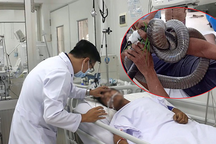 Gia cảnh khốn khó của người "ôm" rắn hổ mang chúa vào bệnh viện cấp cứu