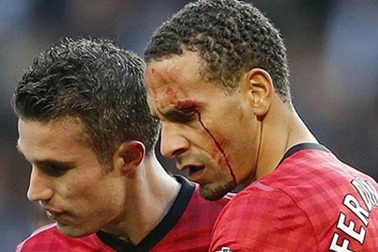 FA điều tra sự cố Rio Ferdinand bị ném rách mặt tại Etihad