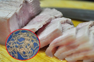 Cách ăn thịt lợn luộc của nhiều gia đình khiến sán lúc nhúc trong người