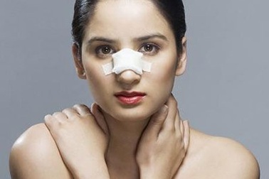 Nâng mũi làm đẹp và những hệ lụy