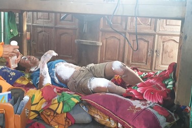 Qua điện đàm, cấp cứu thành công ngư dân bị bỏng nặng toàn thân