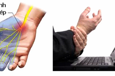 Nguy cơ khi tiêm cortisone trị bệnh xương khớp