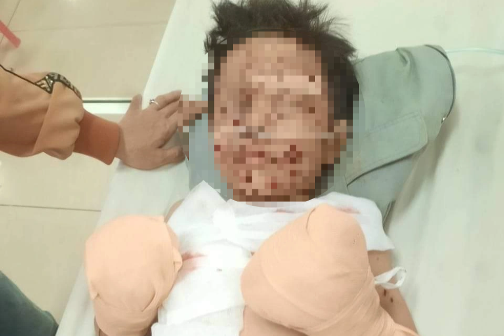 Liên tiếp tai nạn gây thương vong do chế tạo pháo, Đắk Lắk chỉ đạo nóng - 1 Liên tiếp tai nạn gây thương vong do chế tạo pháo, Đắk Lắk chỉ đạo nóng - 1