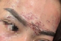 Khởi tố vụ người phụ nữ ở Cà Mau bị xăm lên mặt nghi do ghen tuông