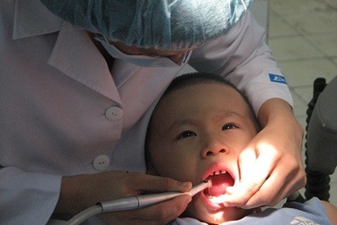 Trên 90% dân số Việt mắc các bệnh về răng lợi