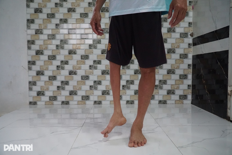 Câu chuyện đằng sau 100 tấm huy chương của VĐV khuyết tật Nguyễn Hoàng Nhã - 2 Câu chuyện đằng sau 100 tấm huy chương của VĐV khuyết tật Nguyễn Hoàng Nhã - 2