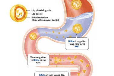 Học ngay cách ứng phó viêm đại tràng của người Nhật