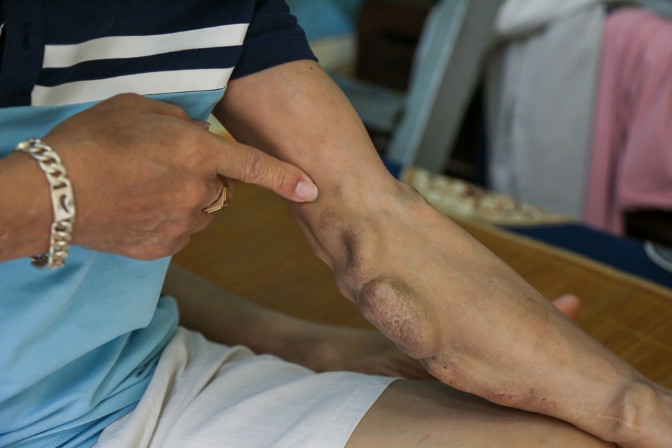 Những gia đình cùng kiệt vì viện phí, mẹ bán nhà đổi vài năm sống cho con - 2 Những gia đình cùng kiệt vì viện phí, mẹ bán nhà đổi vài năm sống cho con - 2