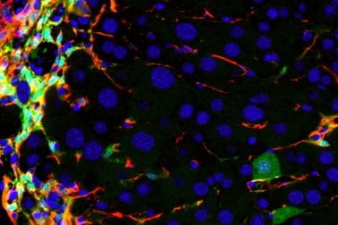 Biến tế bào gây bệnh thành tế bào khỏe mạnh