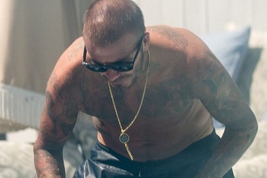 David Beckham bị rụng tóc do tuổi tác