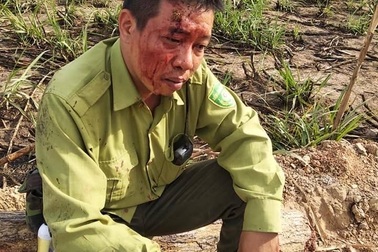 Khởi tố đối tượng vây đánh kiểm lâm toác đầu