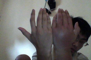 Khó đối phó bọ xít hút máu