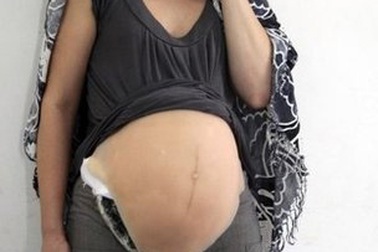 Giả có bầu để vận chuyển ma túy