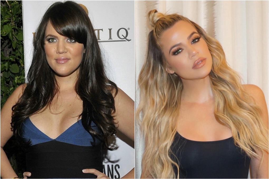 Ngoại hình khác lạ, Khlóe Kardashian phủ nhận tin đồn sửa mặt 12 lần - 1 Ngoại hình khác lạ, Khlóe Kardashian phủ nhận tin đồn sửa mặt 12 lần - 1