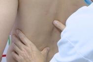 Đi thầy lang nắn bẻ khớp trị đau lưng, người đàn ông 35 tuổi gãy xương nặng