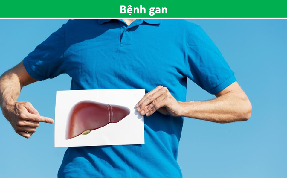 Bàn chân đột nhiên bị sưng, phù không rõ nguyên do cảnh báo bệnh gì? - 3 Bàn chân đột nhiên bị sưng, phù không rõ nguyên do cảnh báo bệnh gì? - 3
