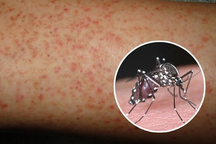 Người đàn ông 49 tuổi tử vong do sốt xuất huyết