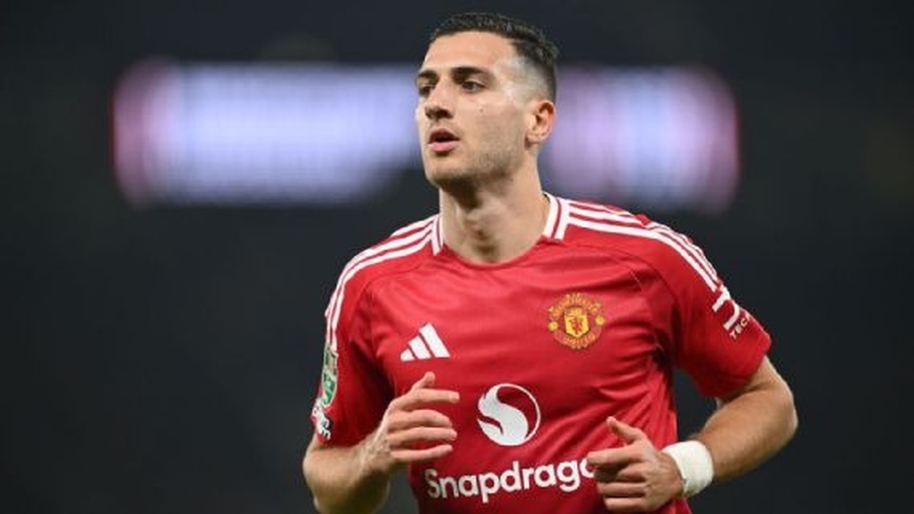 マンU、マンC戦前に大敗 - 1 Man Utd nhận tổn thất lớn trước màn so tài với Man City - 1