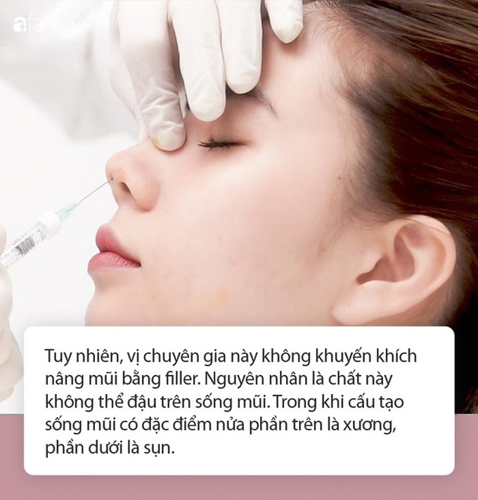 Mù mắt do làm đẹp bằng filler giá rẻ xuất hiện ngày càng nhiều: Khi nào chị em mới biết sợ? - Ảnh 3.