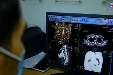 Triệu chứng thường gặp của ung thư phổi