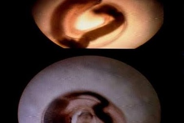 Những lưu ý khi ăn thịt lươn