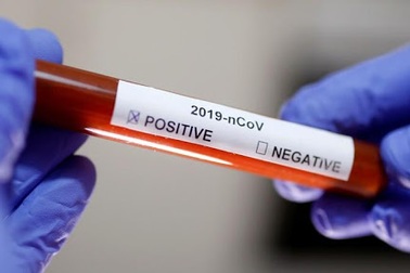 Lỗi phần mềm Excel làm mất dấu gần 16 nghìn bệnh nhân Covid-19