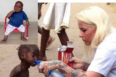 Sự hồi phục thần kỳ của cậu bé Nigeria 2 tuổi từng bị bỏ rơi