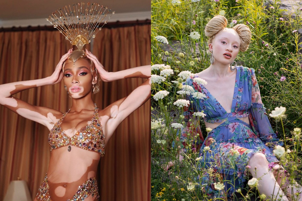 Da nhăn nheo như cụ già, nữ người mẫu 32 tuổi vẫn tự tin diện bikini - 6