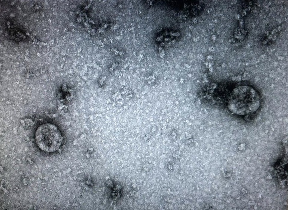 Virus SARS-CoV-2 tại Việt Nam gồm 2 nhánh khác nhau - 1 Virus SARS-CoV-2 tại Việt Nam gồm 2 nhánh khác nhau - 1