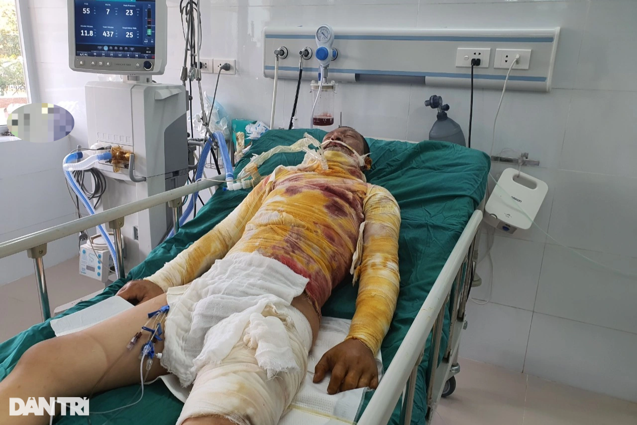 Bapa dalam keadaan kritikal akibat melecur elektrik, tidak dapat melihat muka bayi yang baru lahir - 4 Người cha nguy kịch vì bỏng điện, chưa kịp nhìn mặt con mới sinh - 4