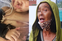 Bà tiết lộ sức khỏe bé trai 2 tuổi nghi bị cha đánh, chích tàn thuốc dã man