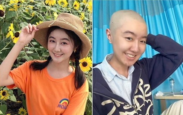 Sao nhí Trung Quốc đăng ảnh xuống tóc vì ung thư, được fan ủng hộ - 1