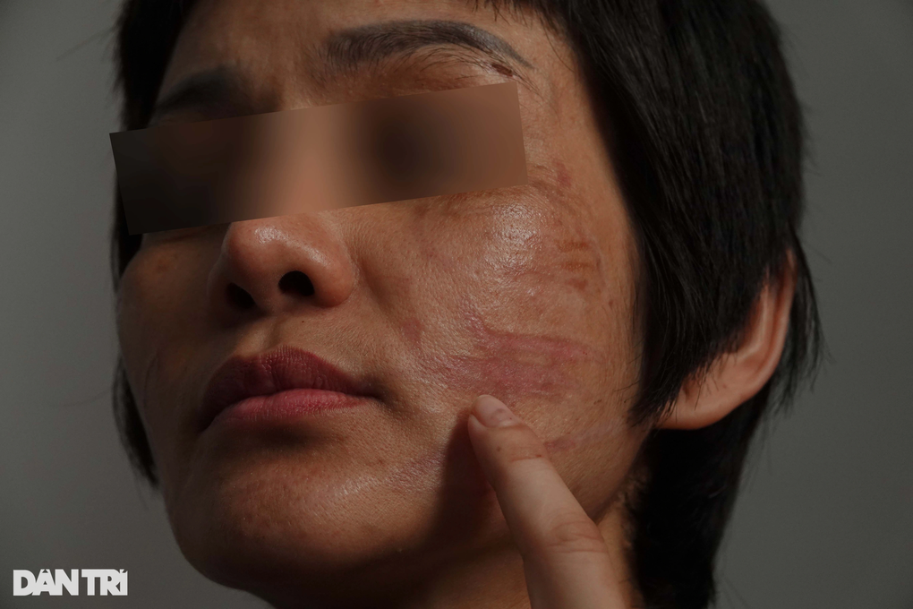 Thai phụ Kiên Giang bị chồng bạo hành: Anh ta nói đánh cho tôi chết từ từ - 4 Thai phụ Kiên Giang bị chồng bạo hành: Anh ta nói đánh cho tôi chết từ từ - 4