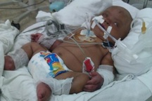 Bé gái mất cả cha lẫn mẹ thoi thóp trên giường bệnh