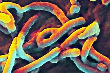 Senegal xác nhận trường hợp đầu tiên nhiễm Ebola là du học sinh