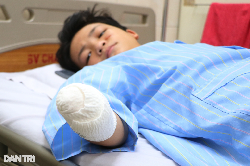 Bé trai 14 tuổi mất bàn tay sau tiếng nổ xé tai, bố nghẹn ngào nghe con hỏi - 2 Bé trai 14 tuổi mất bàn tay sau tiếng nổ xé tai, bố nghẹn ngào nghe con hỏi - 2