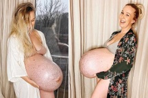 Bụng bầu của người phụ nữ sinh 3 gây sửng sốt trên mạng xã hội