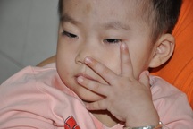 Sặc cháo, bé 3 tuổi bị tổn thương não trầm trọng